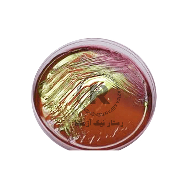 محیط کشت ائوزین متیلن بلو(EMB) کیولب